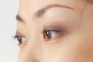 心斎橋でヒアルロン酸注射を打つ